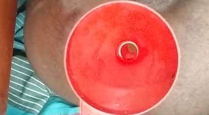Anal insertion