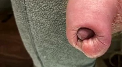Uncut flaccid penis up close, right in your face.