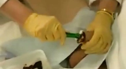 Doctor Inserting A Catheter In A Male Patient's Cock